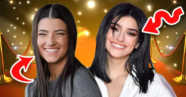 Which Of The Famous D'Amelio Sisters Do You Resemble The Most? Find Out By Taking This Quiz!