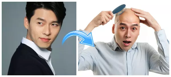 대머리 필터 | 당신이 대머리라면 어떻게 생겼을지 궁금한가요?