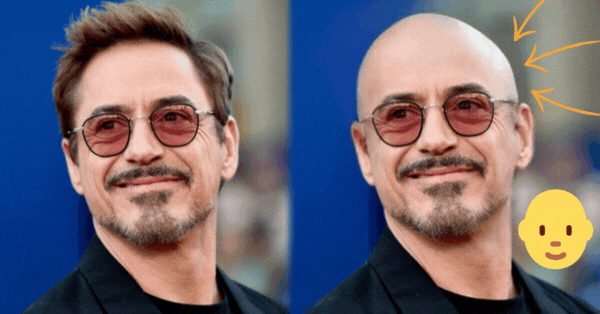 Atreva-se A Ver Como Voc&ecirc; Ficaria Se Ficasse Careca? Filtro Gr&aacute;tis!