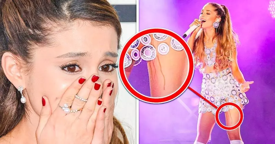 Singers Unbearably Awkward Moments On Stage | Vote And Know A Funny Fact About You