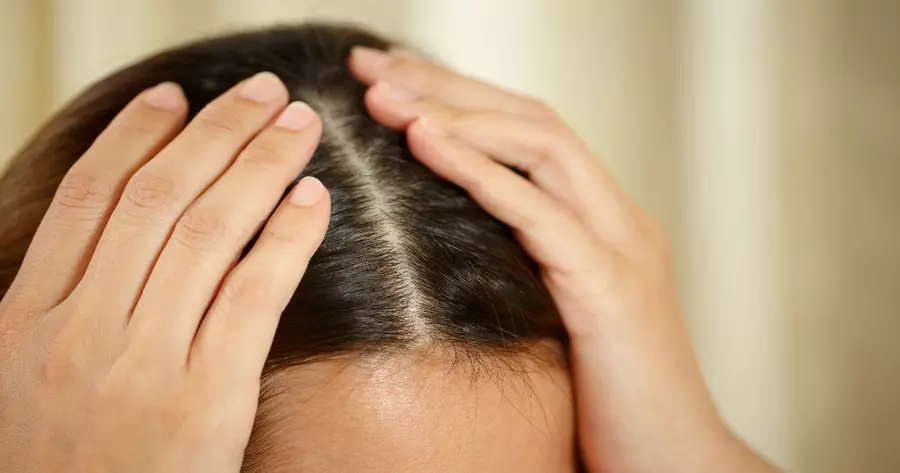 What Does Your Hairline Tells Us About You?