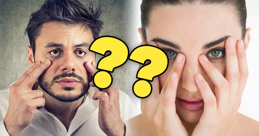 &iquest;Qu&eacute; indica el color de las ojeras?
