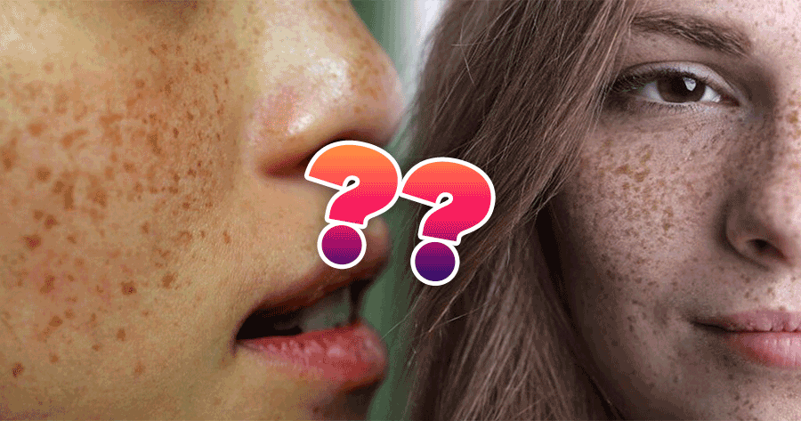 Esto es lo que dicen las pecas de estas 5 zonas de tu cara acerca de tu personalidad.