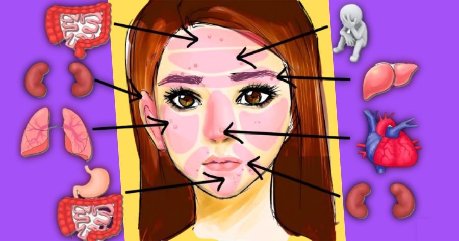 Let's See What Your Acne Reveals About Your Health