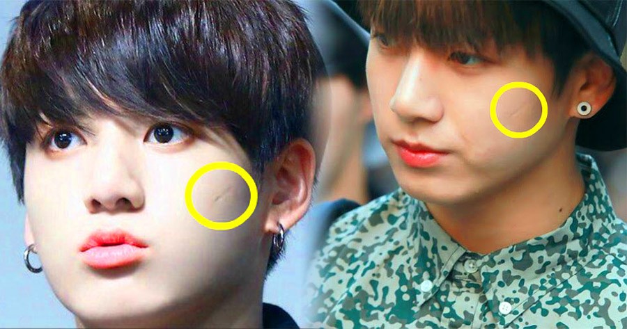 Vết bớt n&oacute;i g&igrave; về bạn?