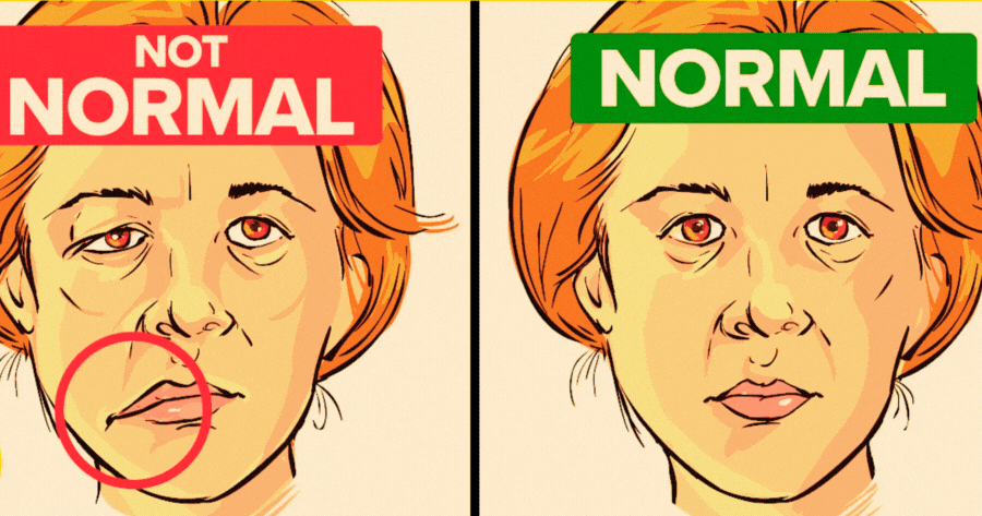 What Your Face Says About Your Health?