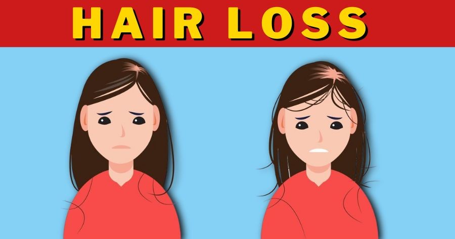 Hair Loss Trivia | Myths And Facts