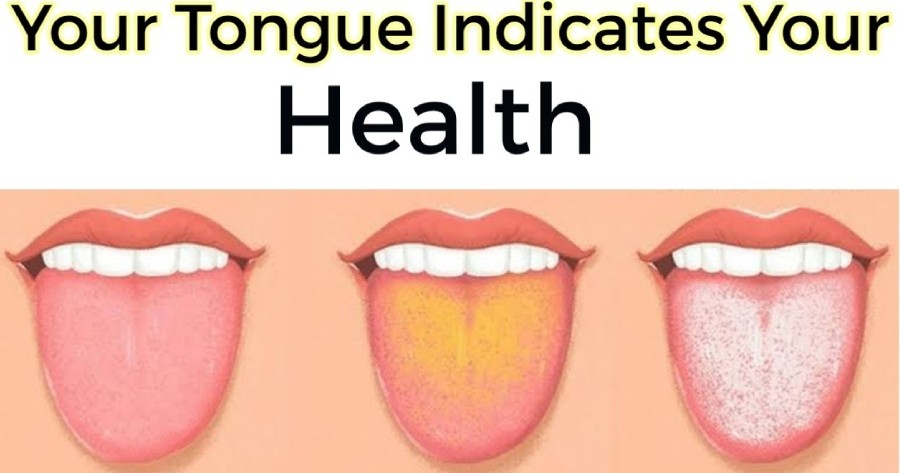 What Your Tongue Tells You About Your Health