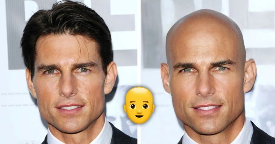 Bald Filter| What Would You Look Like Bald？