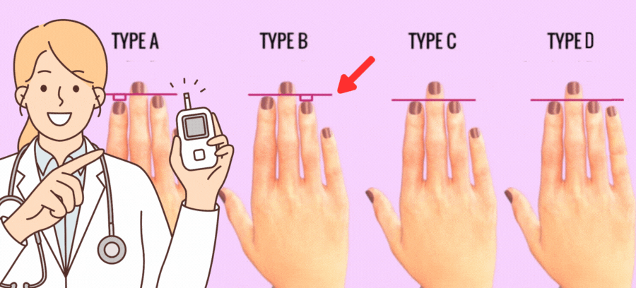 What Does Your Hand Finger Shape Says About Your Health?