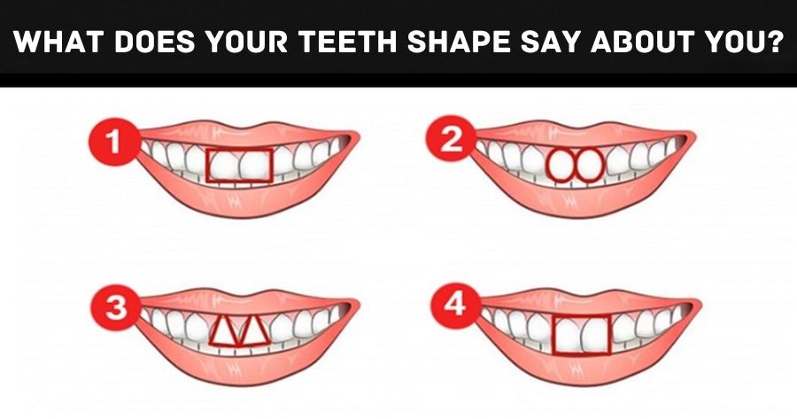 What Does Your Teeth Shape Say About You?