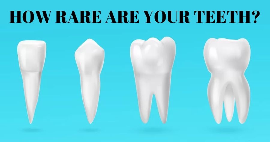 당신의 치아는 얼마나 희귀합니까?