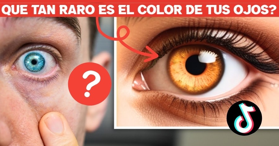 &iquest;Qu&eacute; Tan Raro Es El Color De Tus Ojos?