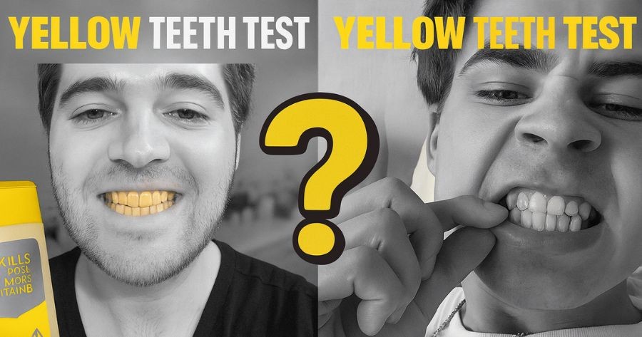 Dişleriniz Ne Kadar Sarı?