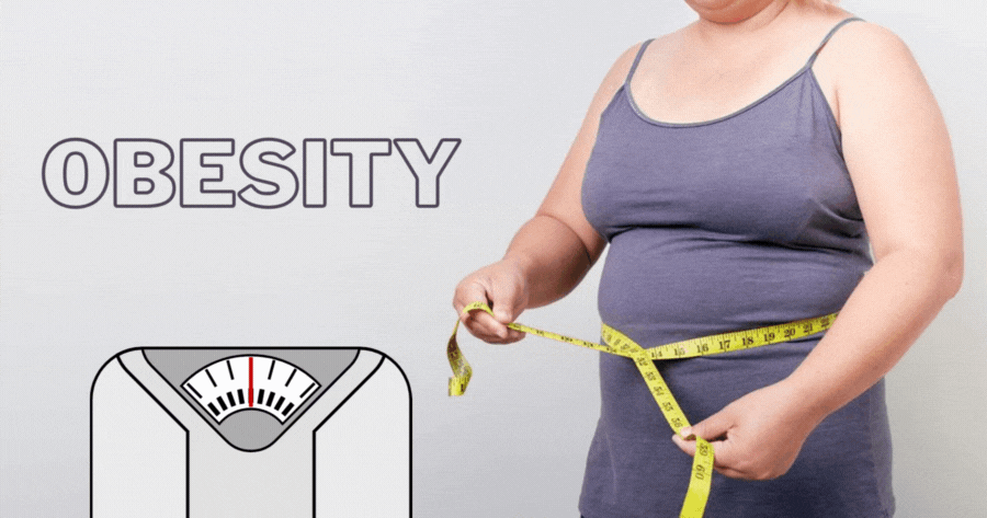 Obezite Risk Endeksiniz Nedir?