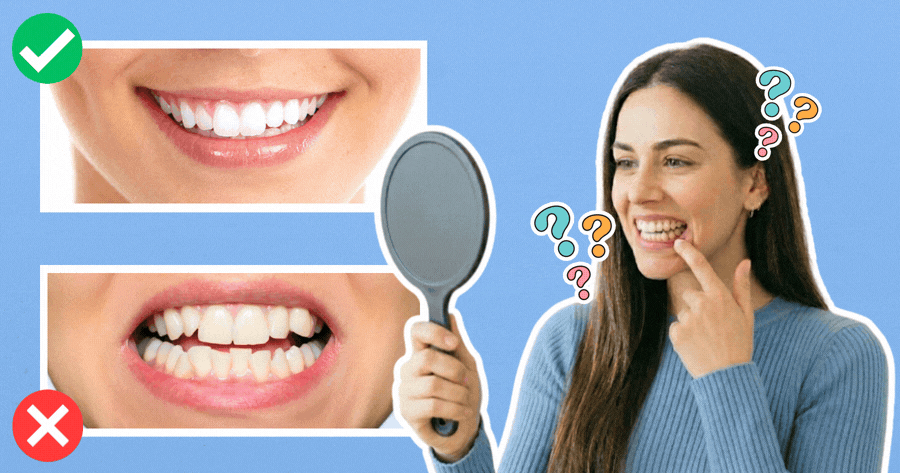 Hvor gode er dine tenner egentlig?