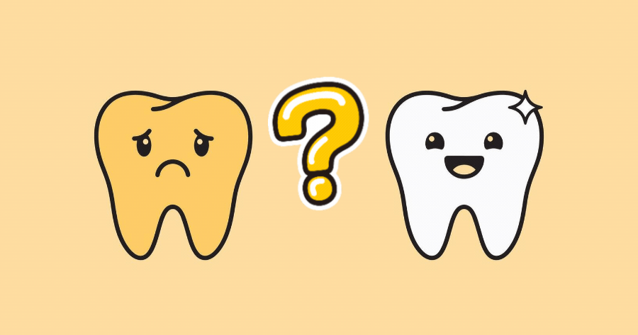 Do You Have White Teeth Or Yellow Teeth?