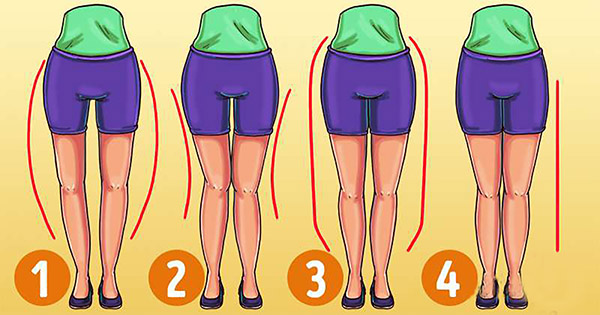 What Exercises Do You Need to Choose According to Your Leg Shape？