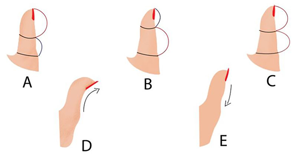  &iquest;Qu&eacute; revela la forma de tu pulgar sobre ti?