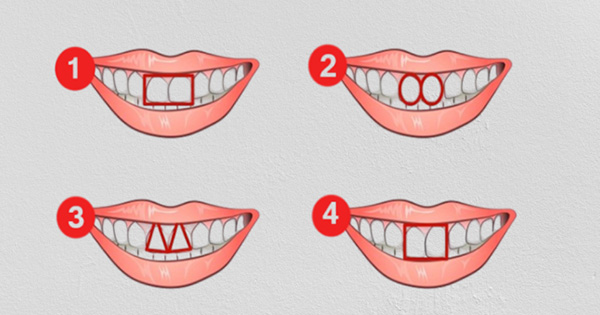 La forma de tus dientes puede revelar el 99% de tu personalidad, &iexcl;descubre con este test!